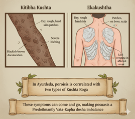 Psoriasis in Ayurveda